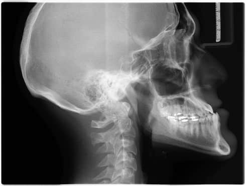 交通事故後の病院での検査